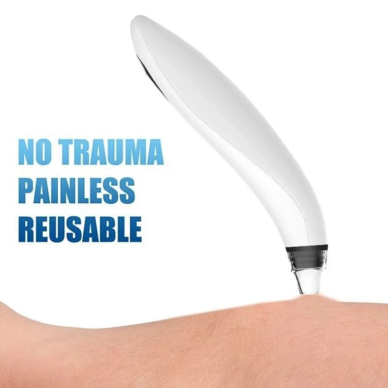 Electric Blackhead Remover