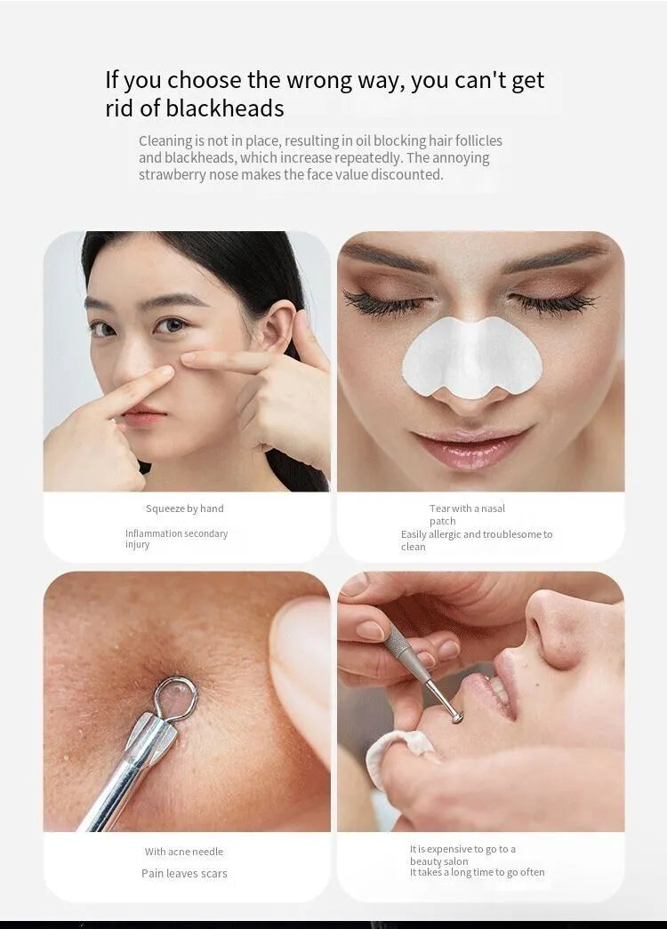 Electric Blackhead Remover